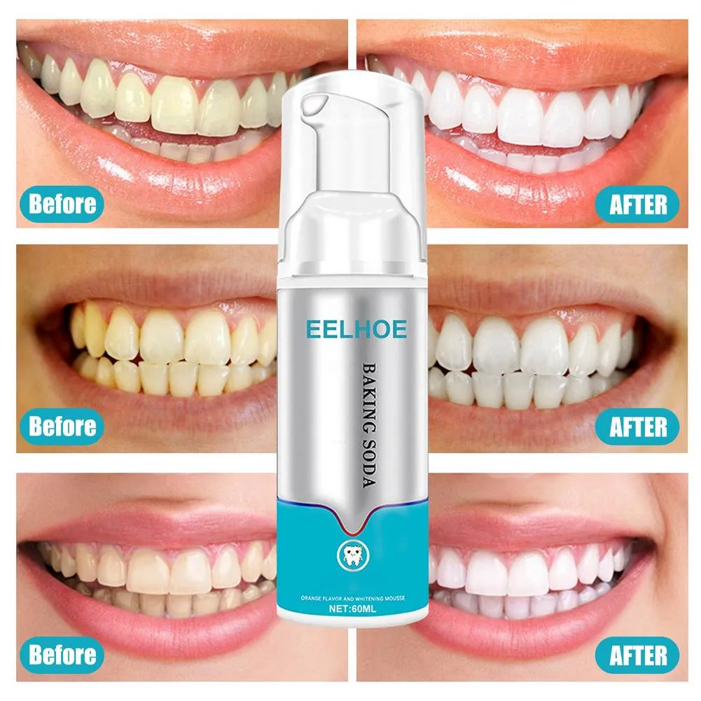 EELHOE Foaming Toothpaste Press-on Whitening Mousse to remove yellow tartar and tobacco stains